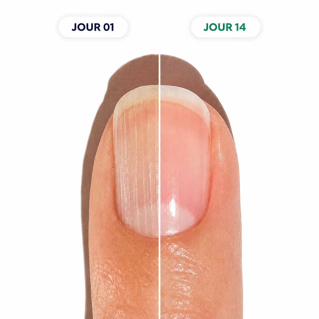 NAILISSA™ Stylo Croissance & Réparation des Ongles