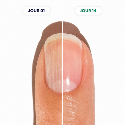 NAILISSA™ Stylo Croissance & Réparation des Ongles
