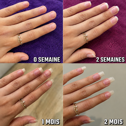 NAILISSA™ Stylo Croissance & Réparation des Ongles